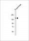 DMBT1 Antibody (C-Term)